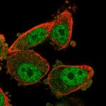 WT1 Antibody in Immunocytochemistry (ICC/IF)