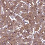 PLA2G4A Antibody in Immunohistochemistry (Paraffin) (IHC (P))