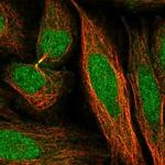 TIRAP Antibody in Immunocytochemistry (ICC/IF)