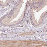 TIRAP Antibody in Immunohistochemistry (Paraffin) (IHC (P))