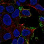 GPR50 Antibody in Immunocytochemistry (ICC/IF)