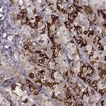 GPR50 Antibody in Immunohistochemistry (Paraffin) (IHC (P))