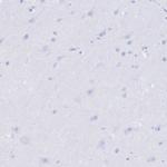 Uromodulin Antibody in Immunohistochemistry (Paraffin) (IHC (P))