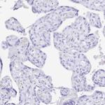 Uromodulin Antibody in Immunohistochemistry (Paraffin) (IHC (P))