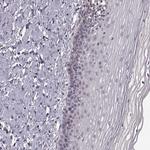 ASIC3 Antibody in Immunohistochemistry (Paraffin) (IHC (P))