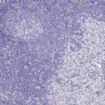 SMURF1 Antibody in Immunohistochemistry (Paraffin) (IHC (P))