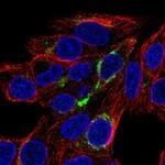 FABP3 Antibody in Immunocytochemistry (ICC/IF)