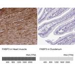 FABP3 Antibody in Immunohistochemistry (Paraffin) (IHC (P))