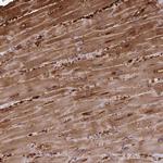 FABP3 Antibody in Immunohistochemistry (Paraffin) (IHC (P))