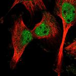 Calpain 10 Antibody in Immunocytochemistry (ICC/IF)