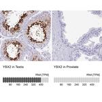 YBX2 Antibody in Immunohistochemistry (Paraffin) (IHC (P))