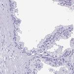 YBX2 Antibody in Immunohistochemistry (Paraffin) (IHC (P))