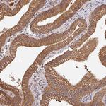 POLG Antibody in Immunohistochemistry (Paraffin) (IHC (P))