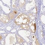 Lactoferrin Antibody in Immunohistochemistry (Paraffin) (IHC (P))