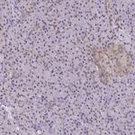 ING4 Antibody in Immunohistochemistry (Paraffin) (IHC (P))