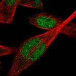 IPMK Antibody in Immunocytochemistry (ICC/IF)