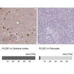 PLCB1 Antibody in Immunohistochemistry (Paraffin) (IHC (P))