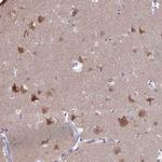 PLCB1 Antibody in Immunohistochemistry (Paraffin) (IHC (P))