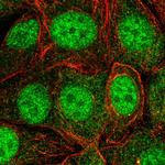 SKP1 Antibody in Immunocytochemistry (ICC/IF)