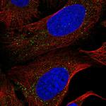 NEK4 Antibody in Immunocytochemistry (ICC/IF)