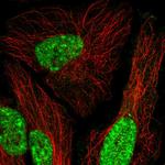 MEIS1 Antibody in Immunocytochemistry (ICC/IF)