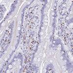 RUNX3 Antibody in Immunohistochemistry (Paraffin) (IHC (P))