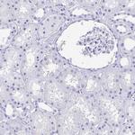 RUNX3 Antibody in Immunohistochemistry (Paraffin) (IHC (P))