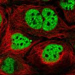 N4BP2L2 Antibody in Immunocytochemistry (ICC/IF)