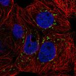 CACNB3 Antibody in Immunocytochemistry (ICC/IF)