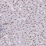 DUT Antibody in Immunohistochemistry (Paraffin) (IHC (P))