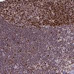 DUT Antibody in Immunohistochemistry (Paraffin) (IHC (P))