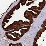 OR10R2 Antibody in Immunohistochemistry (Paraffin) (IHC (P))