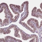 PER2 Antibody in Immunohistochemistry (Paraffin) (IHC (P))