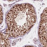 PER2 Antibody in Immunohistochemistry (Paraffin) (IHC (P))