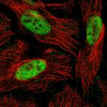 RbAp48 Antibody in Immunocytochemistry (ICC/IF)