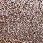 RbAp48 Antibody in Immunohistochemistry (Paraffin) (IHC (P))