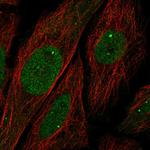 Ubinuclein 1 Antibody in Immunocytochemistry (ICC/IF)