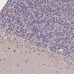 Noggin Antibody in Immunohistochemistry (Paraffin) (IHC (P))