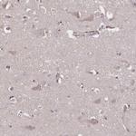 Noggin Antibody in Immunohistochemistry (Paraffin) (IHC (P))