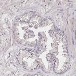 Noggin Antibody in Immunohistochemistry (Paraffin) (IHC (P))