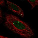 Myeloperoxidase Antibody in Immunocytochemistry (ICC/IF)