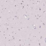 Myeloperoxidase Antibody in Immunohistochemistry (Paraffin) (IHC (P))