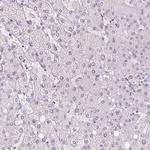 Myeloperoxidase Antibody in Immunohistochemistry (Paraffin) (IHC (P))