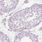 Myeloperoxidase Antibody in Immunohistochemistry (Paraffin) (IHC (P))