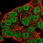 STK39 Antibody in Immunocytochemistry (ICC/IF)