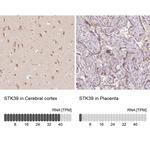 STK39 Antibody in Immunohistochemistry (Paraffin) (IHC (P))