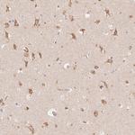 STK39 Antibody in Immunohistochemistry (Paraffin) (IHC (P))