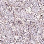 STK39 Antibody in Immunohistochemistry (Paraffin) (IHC (P))