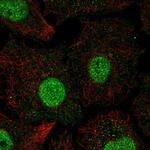 SMAD6 Antibody in Immunocytochemistry (ICC/IF)