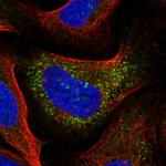 IRX3 Antibody in Immunocytochemistry (ICC/IF)